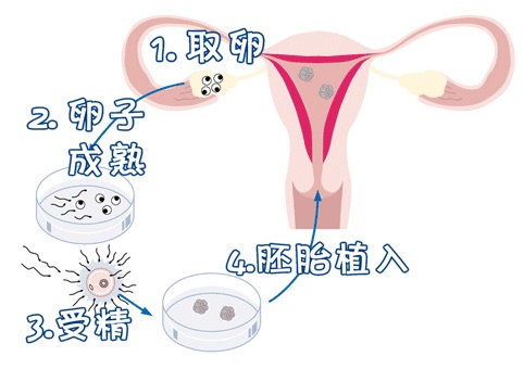 有偿同志供卵咨询怎么找